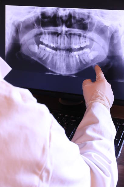Best Emergency Root Canal Treatment in Owens Cross Roads, AL