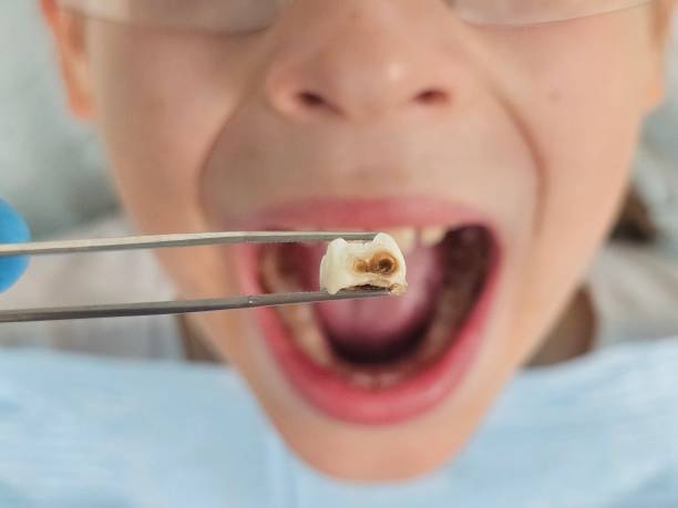 Best Same-Day Emergency Dental Services in Owens Cross Roads, AL